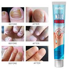 nail repair cream effective toenail