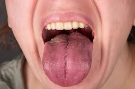 silent signs of mouth cancer