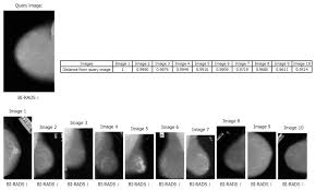 Content Based Image Retrieval Applied To Bi Rads Tissue