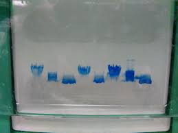 smearing of bands in tris tricine gel