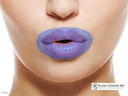 botox lip flip for fuller lips