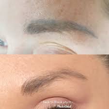 Most people require two sessions to get their ideal brow. About Cosmetic Eyebrow Tattoo Removal
