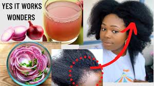 red onion for faster hair growth