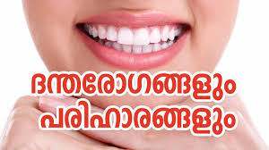 This is a normal part of mouth development. Dental Problems And Solutions In Malayalam à´¦à´¨ à´¤ à´ª à´°à´¶ à´¨à´™ à´™à´³ à´ªà´° à´¹ à´°à´™ à´™à´³ Youtube