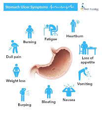 what are the symptoms of stomach ulcer