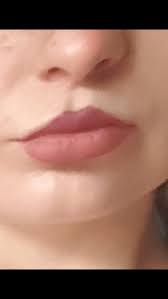 my lip shape and increase my lips