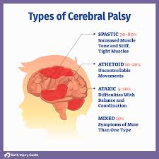 Cerebral Palsy Types