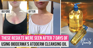 bioderma atoderm cleansing oil review