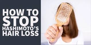 how to stop hashimoto s hair loss 3