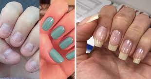 strengthener to grow naturally long nails