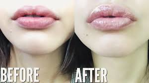 bigger lips naturally without makeup