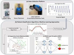General versus special senses and the retinas. Using A Motion Sensor To Categorize Low Back Pain Patients A Machine Learning Approach Biorxiv