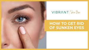 how to get rid of sunken eyes 7 tips