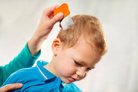home remes to get rid of head lice