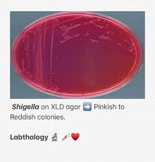 Bacteria were not cultivated on the plate in image a. L A B T H O L O G Y On Twitter Xylose Lysine Deoxycholate Xld Agar Is A Selective Medium For The Isolation Of Salmonella And Shigella Spp From