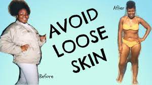 avoid loose skin during and after
