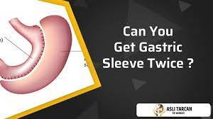 can you get gastric sleeve twice asli