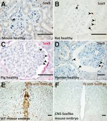 glomerular sox9 cells