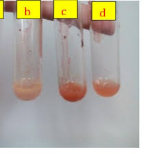 It appears as reddish brown crystals with melting. Pdf Comparative Analysis Of The Lipid Protein And Starch Content In The Endosperm Of Laguna Tall And Philippine Lono Tall Coconut Cocos Nucifera Varieties
