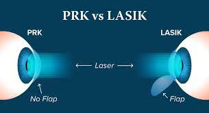 lasik and prk eye surgery