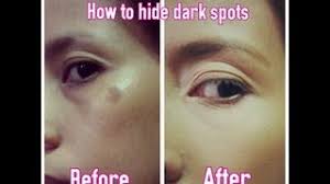 conceal dark spots with makeup