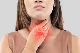thyroid low thyroid hypothyroidism