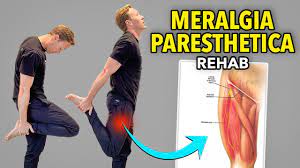 3 fem nerve exercises meralgia