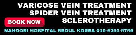 vein treatment specialists in korea