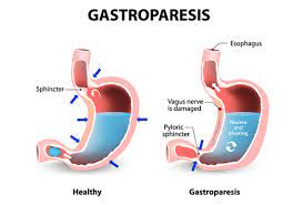 Gastroenterology Consultants of San Antonio gambar png