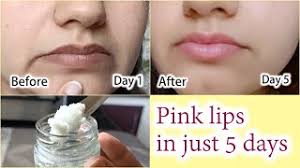 home remedy for dark lips