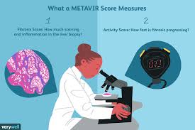Metavir Score Uses And Results