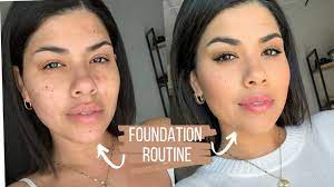 foundation routine for acne dry skin