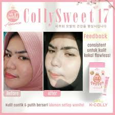 Keistimewaan k colly sweet 17 : Kcolly Sweet 17 Health Beauty Face Skin Care On Carousell
