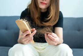 polycystic ovary syndrome pcos hair loss