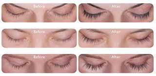 Do not apply to lower lid. Latisse Longer Eyelashes Charleston Cosmetic Surgery Cosmetic Procedures How To Grow Eyelashes Eyelash Growth