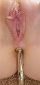 Anal hook insertion
