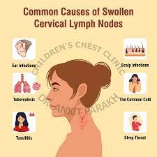 enlarged cervical lymph nodes