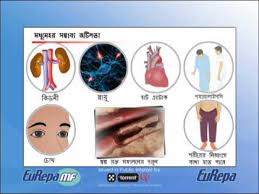 Intro Diabetes Bengali