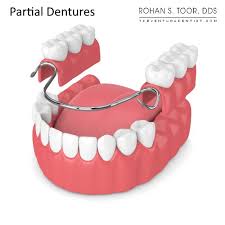partial dentures process problems