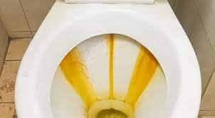 Fix Leaking Toilet Cistern