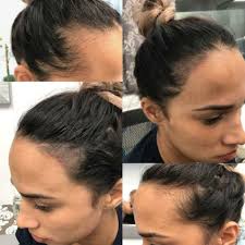 great neck scalp pigmentation services