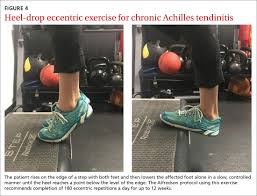 exercises for chronic musculoskeletal