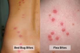 bed bugs bite vs flea bite what s the