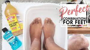 vinegar foot soak listerine foot bath