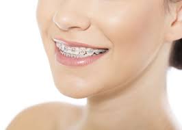 Can you fix an overbite naturally. Will Braces Change How I Look Orthodontic Treatment