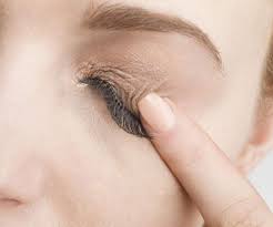 eyelid rash dermais symptoms and
