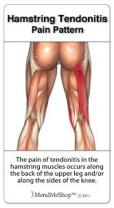 Information from webmd on tendon ruptures, a potentially serious problem that may result in excruciating pain and permanent disability if a tendon is the fibrous tissue that attaches muscle to bone in the human body. Hamstring Injury Information And Treatments