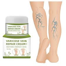 herbal varicose vein repair cream