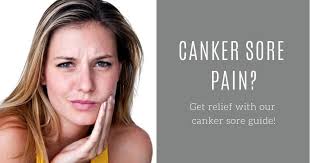 your guide to canker sores symptoms
