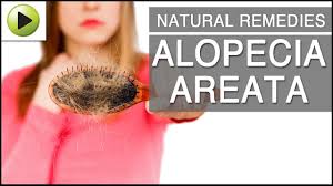 home remes for alopecia areata